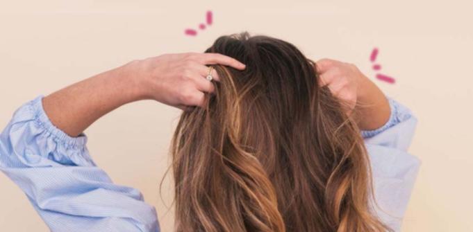 cuero-cabelludo-con-descamacion